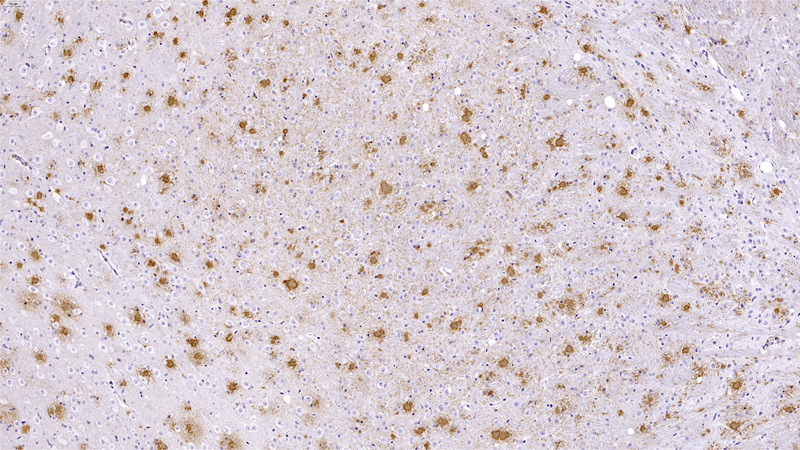 Beta amyloid (TG_10 month)