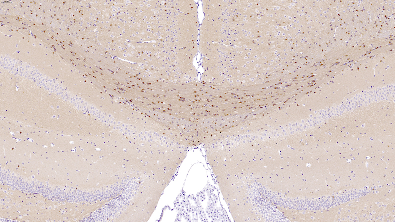 TAU (TG) Low Magnification