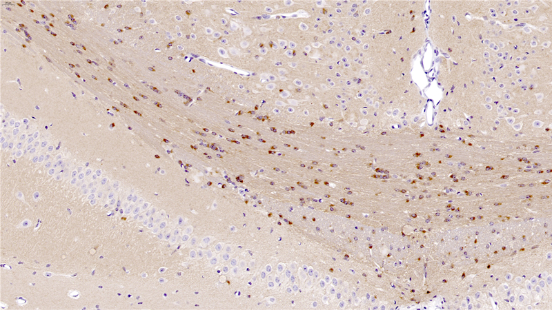 TAU (TG) High Magnification