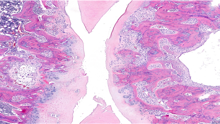 H&E / Arthritis Cartilage