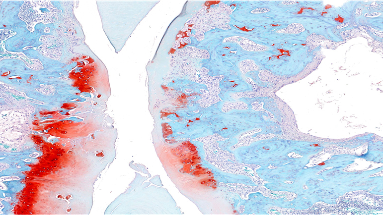 Safranin O / Arthritis Cartilage