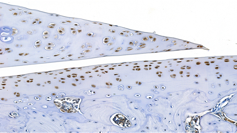 IHC_IL-1β< / Normal Cartilage