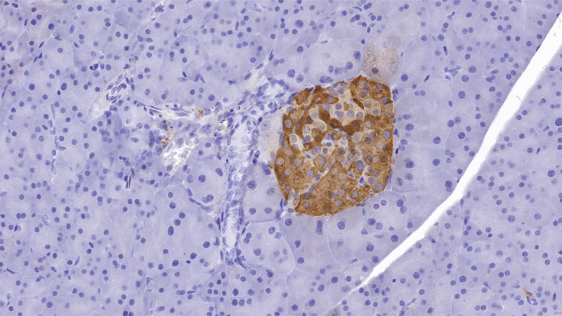 IHC_Insulin / Normal