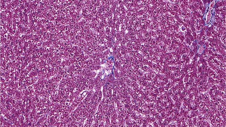 Masson’s Trichrome / Normal Control