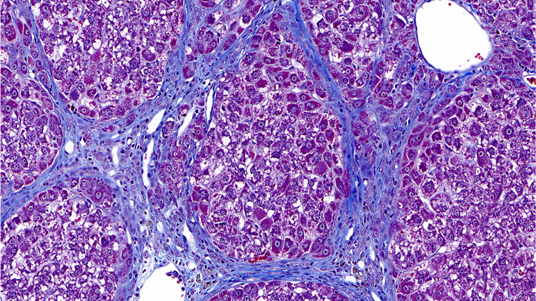 Masson’s Trichrome / Fibrosis Control