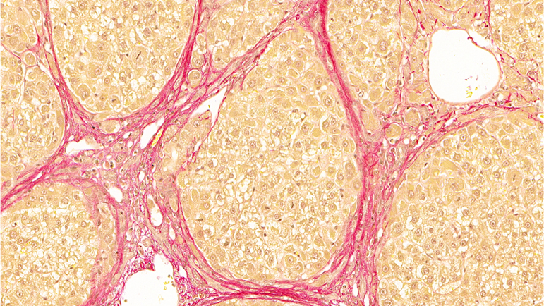 Picro Sirius Red / Fibrosis Control