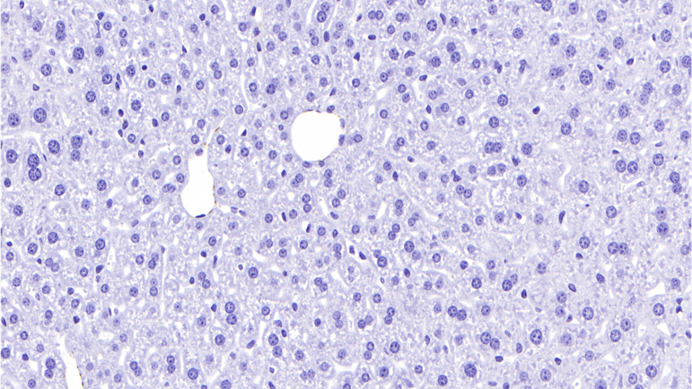 IHC_α-SMA / Normal Control