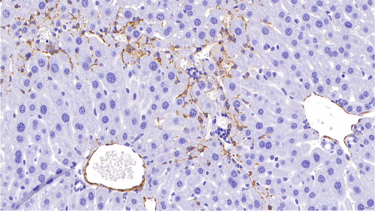 IHC_α-SMA / Fibrosis Control