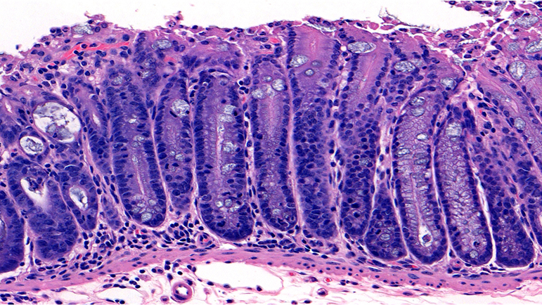 H&E / Normal Colon