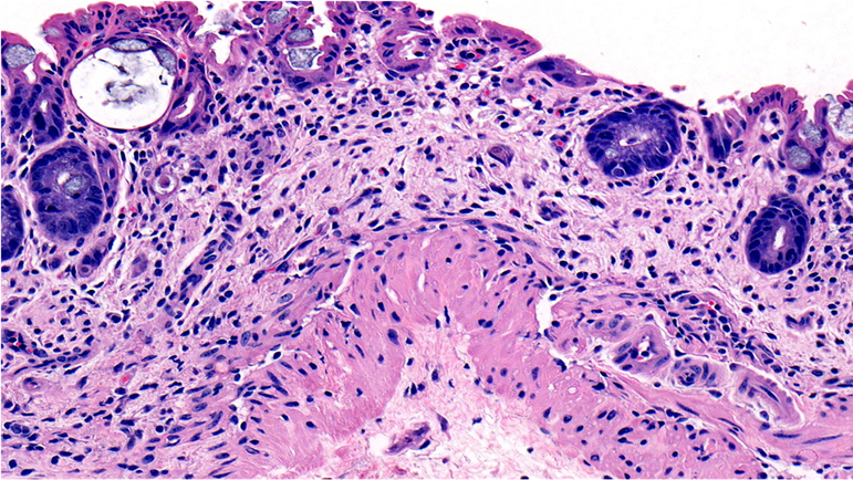 H&E / Colitis