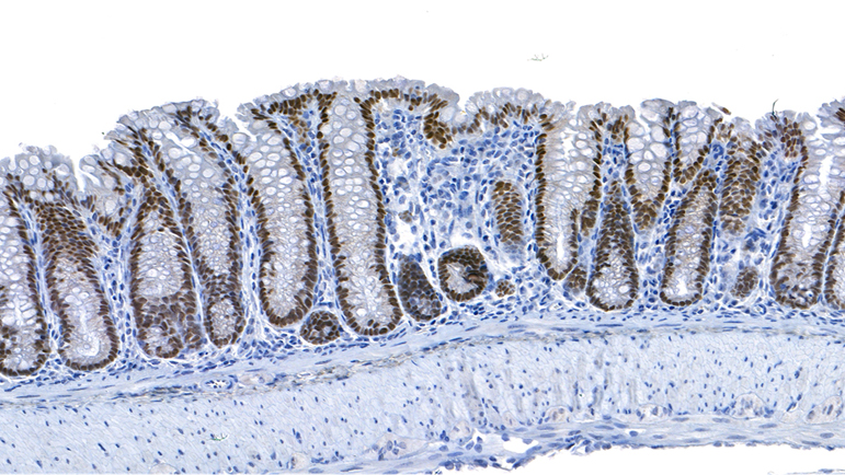 IHC_CDX2 / Normal Colon