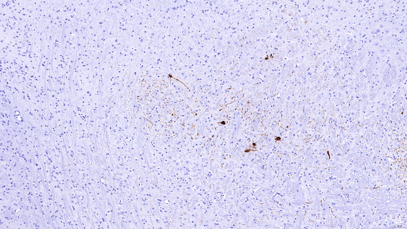 Tyrosine Hydroxylase 3 Month