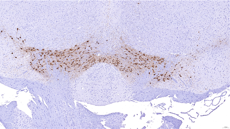 Tyrosine Hydroxylase 9 Month