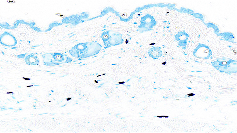 Toluidine blue / Normal skin