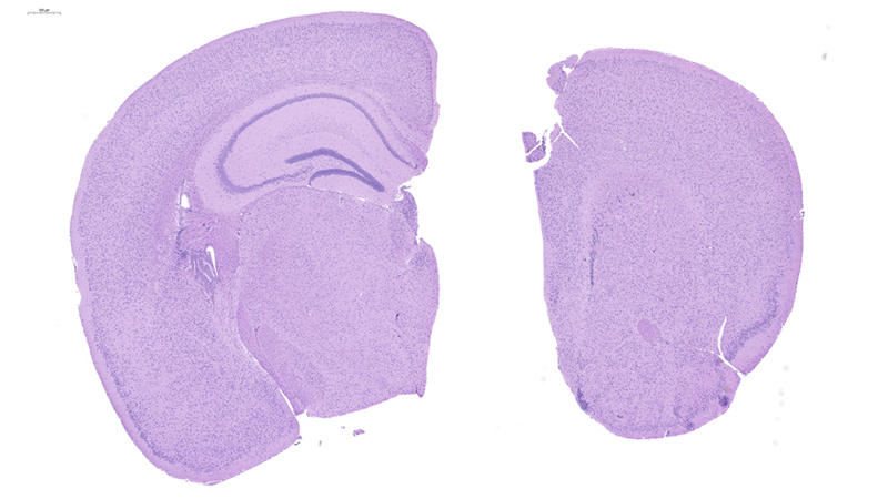 Brain / Low Magnification