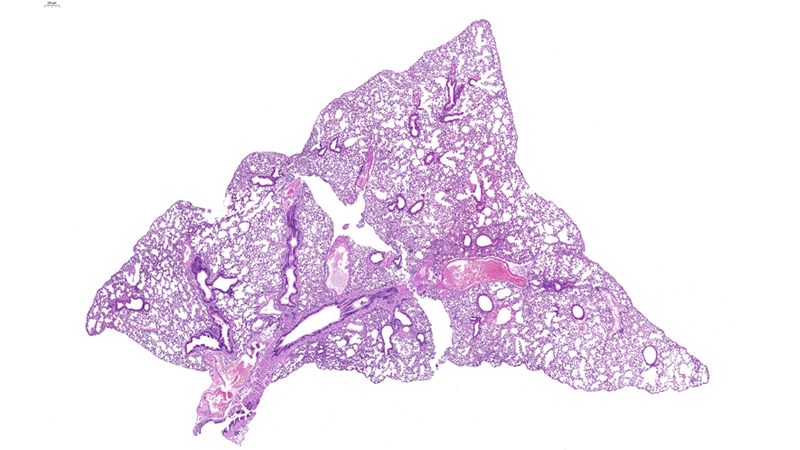 Lung / Low Magnification