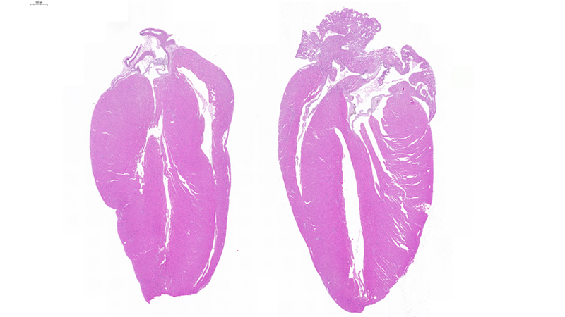 Heart / Low Magnification