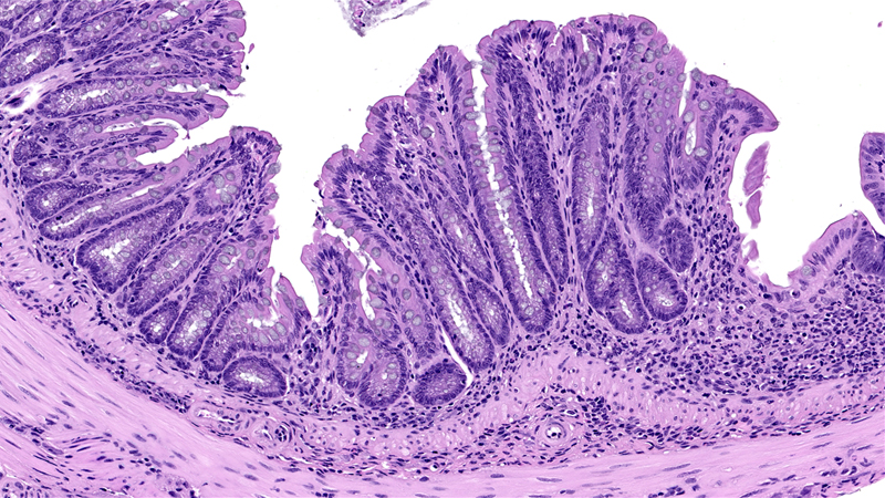 Large intestine / High Magnification