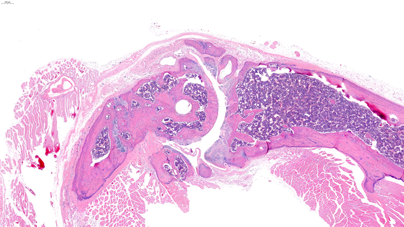 Arthritis / Low Magnification