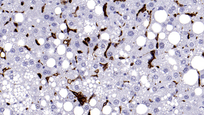 Immunohistochemistry: IHC