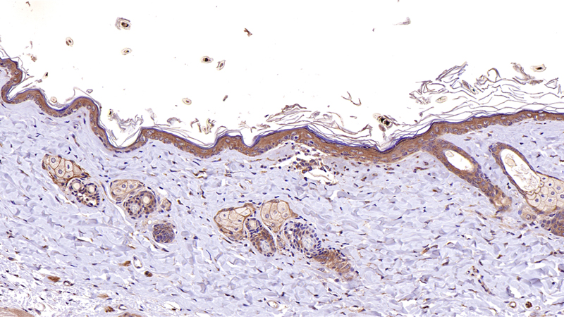 N-cadherin