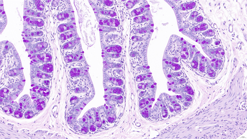 Large intestine