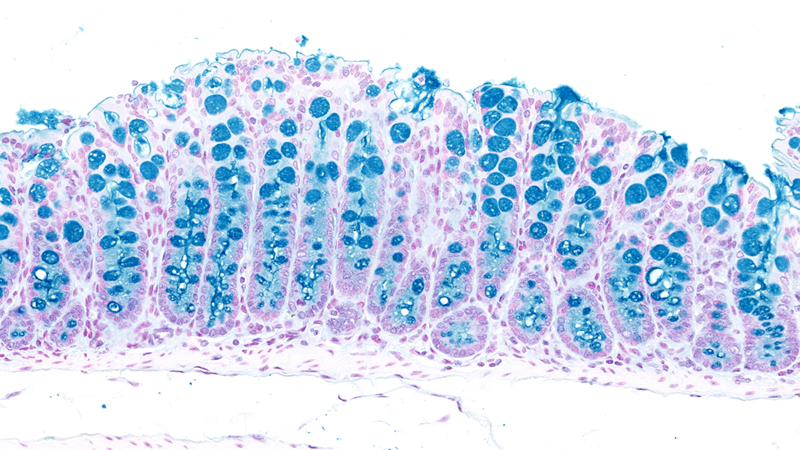 Large intestine