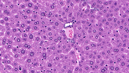 H&E Stain